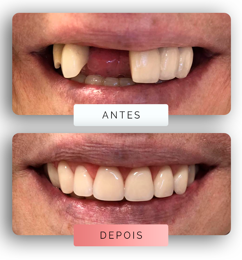 Página - Antes e depois 1