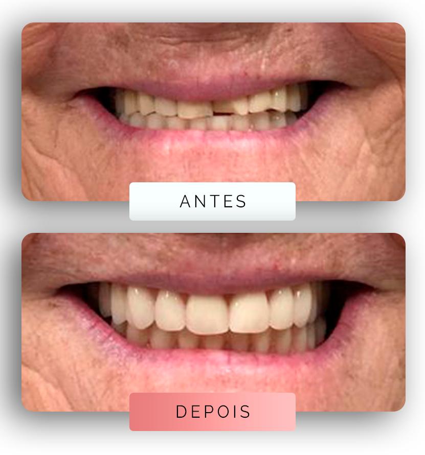 Página - Antes e depois 2