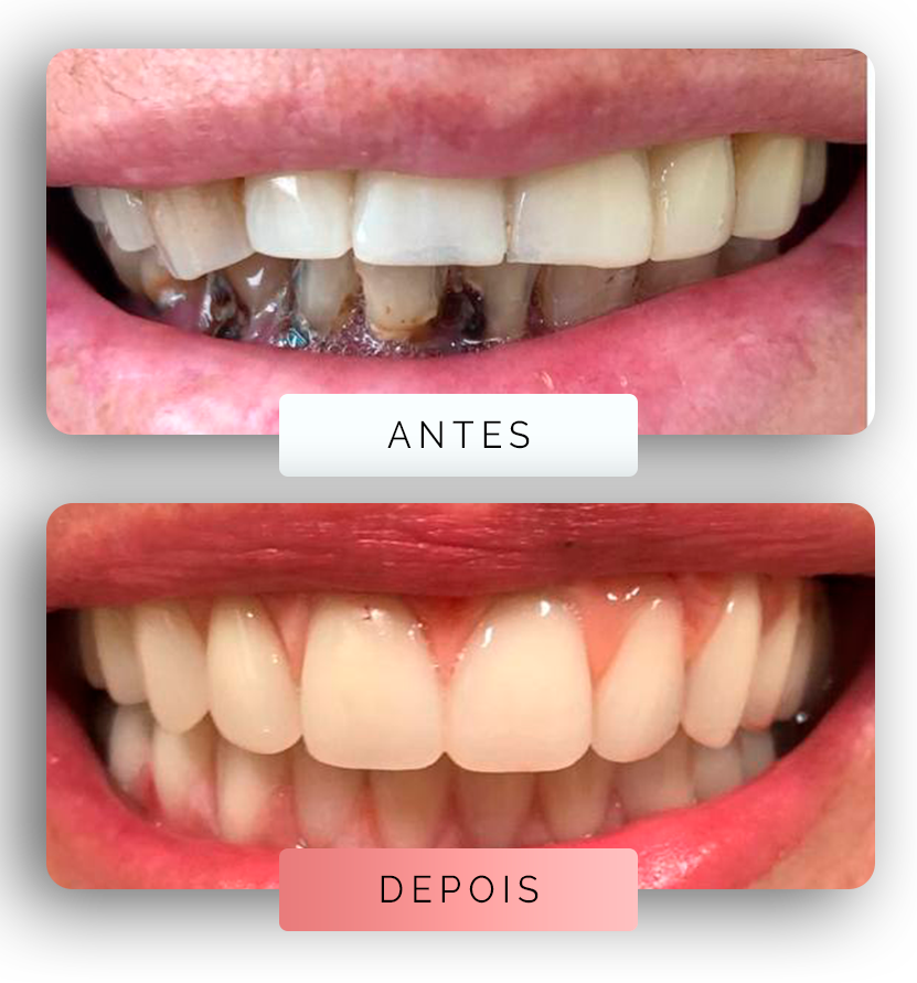 Página - Antes e depois 3